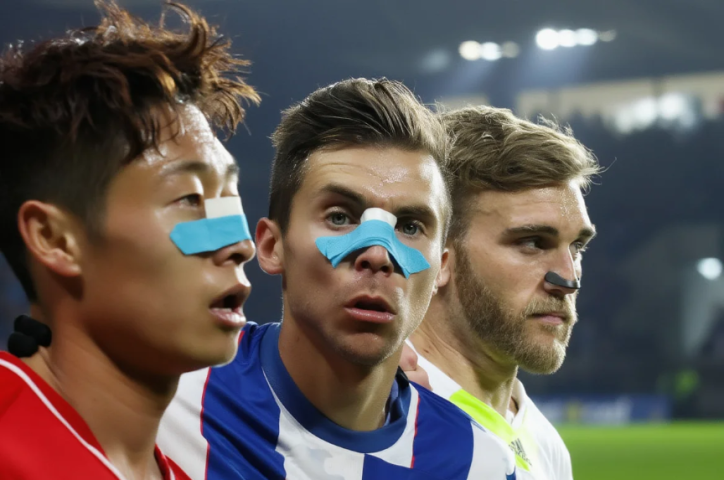 Coupe du Monde 2026 et bandes nasales